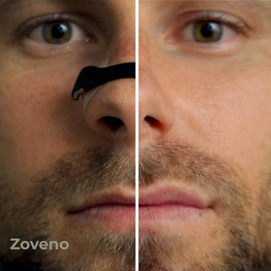 Zoveno™ Magnetic Nose Strips